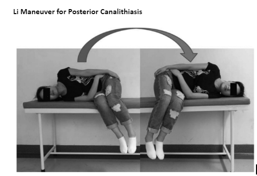 li maneuver for posterior canalithiasis