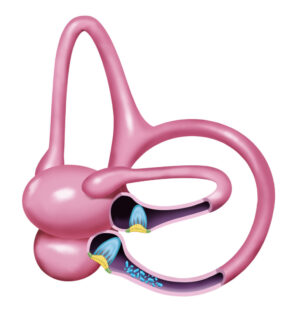 A-042 BPPV overview (new)_v2 (1)