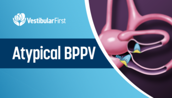 Atypical BPPV