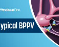 Atypical BPPV