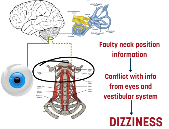 Cervicogenic Dizziness | Vestibular First