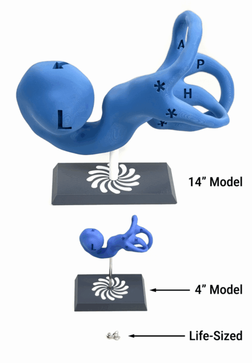 Vestibular Today Model Comparison