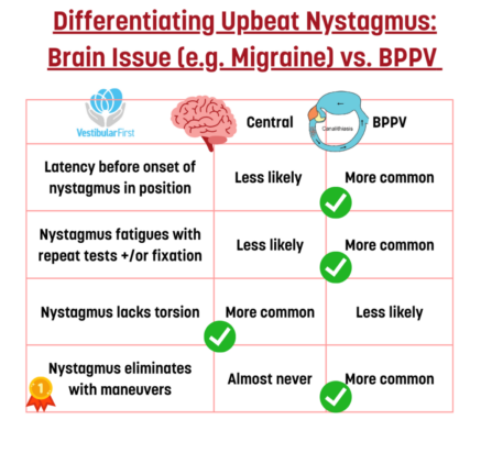 Upbeat Nystagmus and bppv