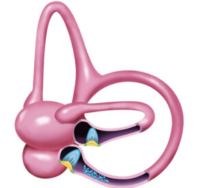 A-042 BPPV overview (new)_v2 (2)